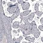 Immunohistochemical staining of human placenta shows no positivity in trophoblastic cells as expected.