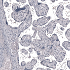 Anti-CLDN3 Antibody