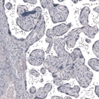 Immunohistochemical staining of human placenta shows no positivity in trophoblastic cells as expected.