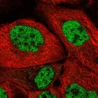 Immunofluorescent staining of human cell line A-431 shows localization to nucleoplasm.