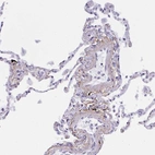Anti-ELN Antibody