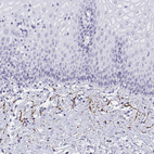 Immunohistochemical staining of human uterine cervix shows moderate positivity in extracellular matrix in stromal cells.