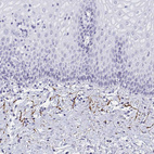 Anti-ELN Antibody