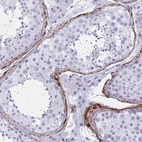 Immunohistochemical staining of human testis shows moderate positivity in extracellular matrix in peritubular myoid cells.