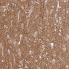 Immunohistochemical staining of human cerebral cortex shows strong positivity in neuropil.