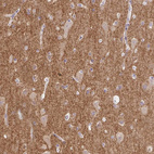 Anti-DBN1 Antibody