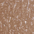 Immunohistochemical staining of human cerebral cortex shows strong positivity in neuropil.