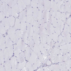 Anti-ELN Antibody