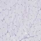 Immunohistochemical staining of human skeletal muscle shows no positivity in myocytes as expected.