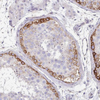 Immunohistochemical staining of human testis shows strong membranous positivity in spermatogonia.
