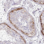 Immunohistochemical staining of human testis shows strong membranous positivity in spermatogonia.