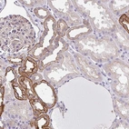 Immunohistochemical staining of human kidney shows strong membranous positivity in cells in tubules.