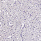 Immunohistochemical staining of human liver shows no positivity in hepatocytes as expected.