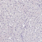 Immunohistochemical staining of human liver shows no positivity in hepatocytes as expected.