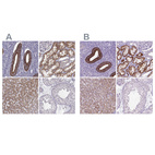 Immunohistochemical staining of human endometrium, kidney, liver and testis using Anti-KMO antibody HPA056942 (A) shows similar protein distribution across tissues to independent antibody HPA031115 (B).