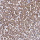 Anti-KMO Antibody