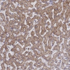 Immunohistochemical staining of human liver shows strong cytoplasmic granular positivity in hepatocytes.