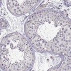 Immunohistochemical staining of human testis shows no positivity in cells in seminiferous ducts as expected.