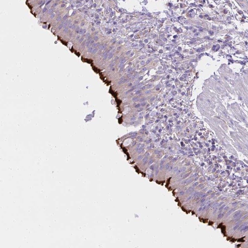 Anti-CCDC142 Antibody