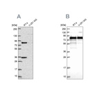 Western blot analysis using Anti-CLINT1 antibody HPA056947 (A) shows similar pattern to independent antibody HPA043280 (B).