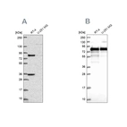 Western blot analysis using Anti-CLINT1 antibody HPA056947 (A) shows similar pattern to independent antibody HPA043280 (B).