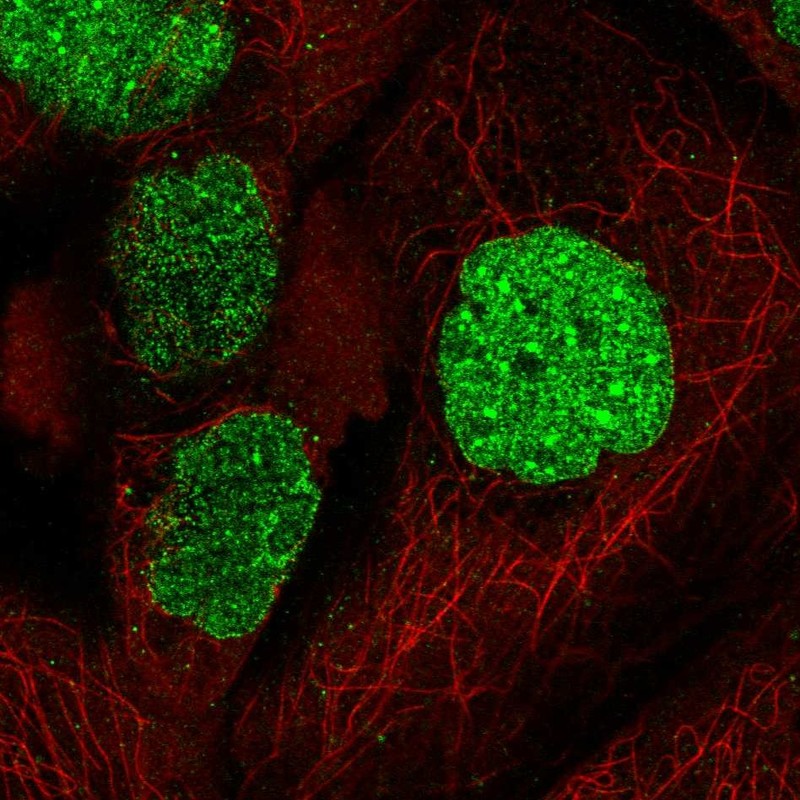 Anti-SUMO1 Antibody