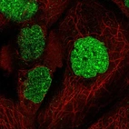 Anti-SUMO1 Antibody