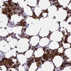 Anti-ANK1 Antibody