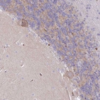 Immunohistochemical staining of human cerebellum shows weak membranous and cytoplasmic positivity in Purkinje cells.