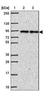 Lane 1: Marker [kDa] 250, 130, 95, 72, 55, 36, 28, 17, 10_br/_Lane 2: Human cell line RT-4_br/_Lane 3: Human cell line U-251MG sp