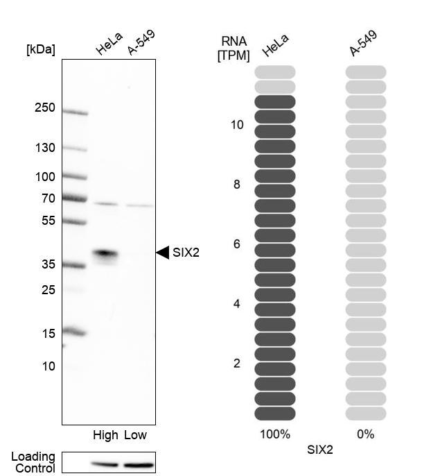 Anti-SIX2 Antibody