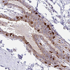 Immunohistochemical staining of human breast shows moderate to strong cytoplasmic positivity in a subset of glandular cells.