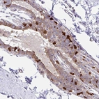 Immunohistochemical staining of human breast shows moderate to strong cytoplasmic positivity in a subset of glandular cells.