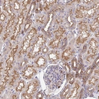 Immunohistochemical staining of human kidney shows moderate membranous positivity in cells in tubules.