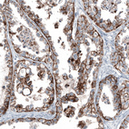 Anti-CLDN3 Antibody