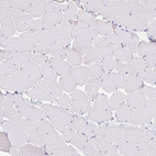 Immunohistochemical staining of human skeletal muscle shows no positivity in myocytes as expected.