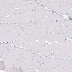 Immunohistochemical staining of human skeletal muscle shows no positivity in myocytes as expected.