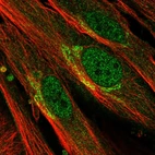 Immunofluorescent staining of human cell line BJ shows localization to nucleoplasm & the Golgi apparatus.
