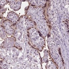 Anti-C2orf16 Antibody