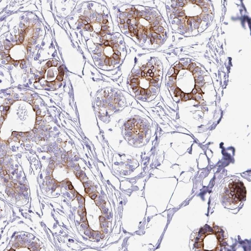 Anti-CLDND2 Antibody