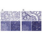 Anti-PSMB11 Antibody