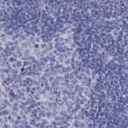 Immunohistochemical staining of human lymph node using Anti-PSMB11 antibody HPA056970.