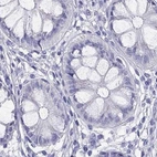 Immunohistochemical staining of human colon using Anti-PSMB11 antibody HPA056970.