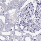 Immunohistochemical staining of human kidney using Anti-PSMB11 antibody HPA056970.