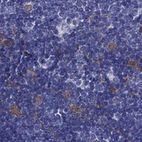 Immunohistochemical staining of human thymus using Anti-PSMB11 antibody HPA056970.