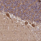 Anti-ANKRD33B Antibody