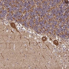 Anti-ANKRD33B Antibody