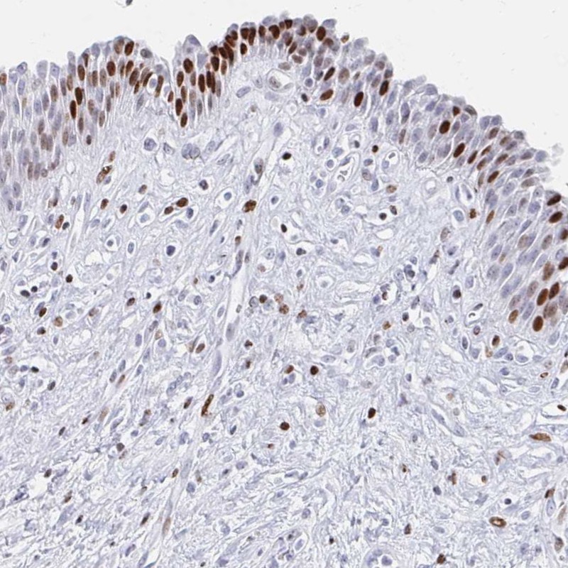 Anti-SRSF3 Antibody