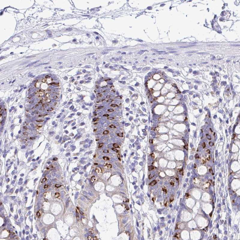 Anti-NLRP8 Antibody