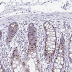 Anti-NLRP8 Antibody